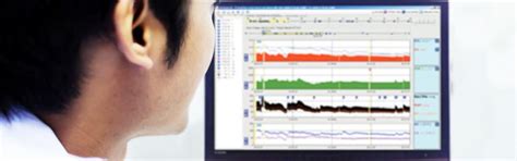 Calibrated Lidco Hemodynamic Monitoring For The Entire Patient Pathway