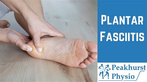 Physiotherapy For Plantar Fasciitis Peakhurst Physio