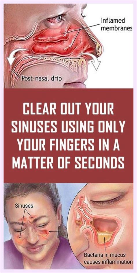 here s how to clear your sinuses quickly in just two steps sinusitis how to clear sinuses