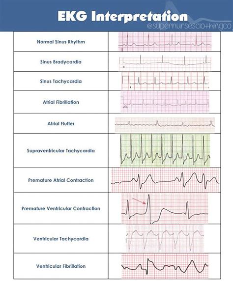 Most nurses have to interpret ekg rhythms every day. EKG Interpretation | Nurse, Ekg interpretation, Critical care nursing