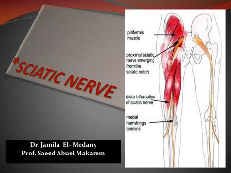 Ppt Sciatic Nerve Powerpoint Presentation Free Download Id2103698