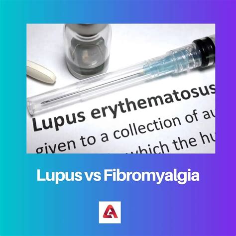Difference Between Lupus And Fibromyalgia