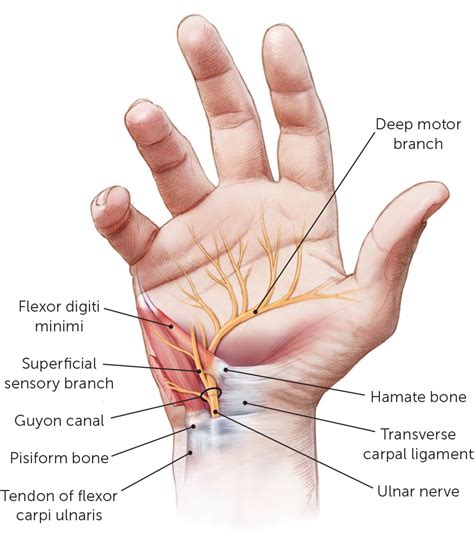 Peripheral Nerve Entrapment And Injury In The Upper Extremity Aafp