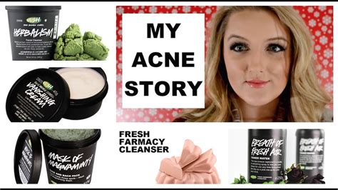 My Acne Story Lush Saved My Skin Youtube