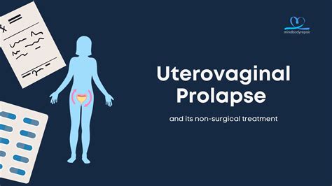 Get Quick And Non Invasive Relief From Uterovaginal Prolapse With