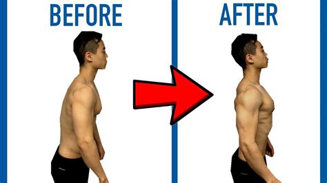 How To Fix Your Posture In Zero Minutes Per Day Fix Rounded Shoulders