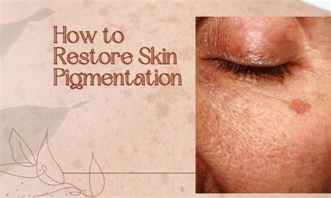 How To Restore Skin Pigmentation Skin Beauty