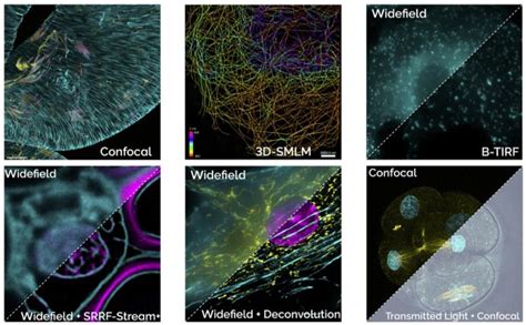 Andor Dragonfly High Speed Confocal Microscope Systems Coherent