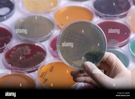 Collection Of Culture Plates Contain Growth Of Microorganisms On