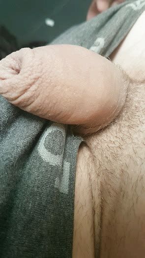 My Girlfriends Stretched Pussy