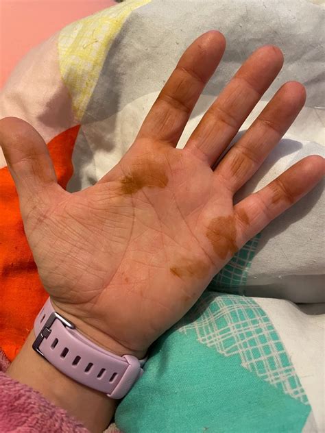 Mystery Of The Stained Hands Health Everybump Parenting And Lifestyle