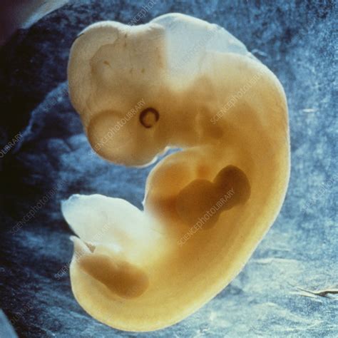 Human Embryo 5 Weeks Stock Image C0559869 Science Photo Library