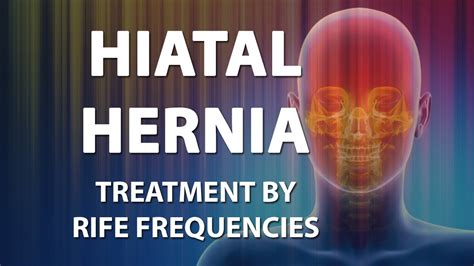 Hiatal Hernia Rife Frequencies Treatment Energy And Quantum Medicine
