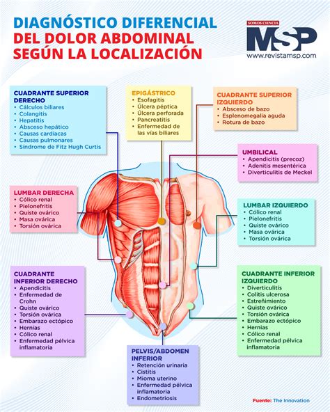 Diagnóstico diferencial del dolor abdominal según la locación Infografía