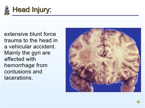 Pathology Of Head Injury