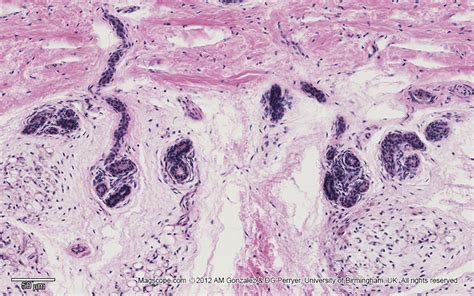 Micrograph Illustrating The Coiled Tubular Eccrine Sweat Glands Within