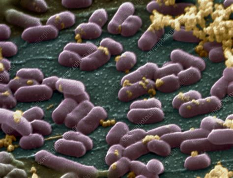 Learn and reinforce your understanding of listeria monocytogenes through video. Listeria monocytogenes bacteria - Stock Image - B220/1033 ...