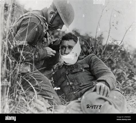 War Wound Hi Res Stock Photography And Images Alamy