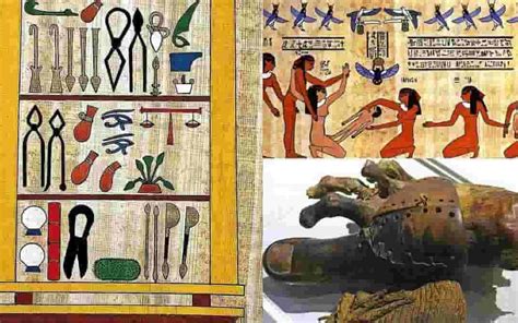 ancient egyptian medicine