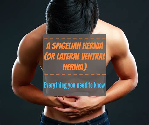 A Spigelian hernia (or lateral ventral hernia) - Everything you need to know - The Healthy Apron