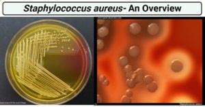 Staphylococcus Aureus An Overview Microbe Notes