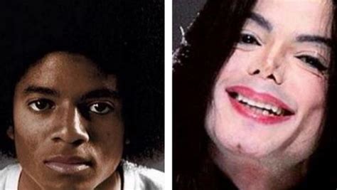 La Obsesi N De Michael Jackson Por Su Nariz Que Le Llev A Realizarse Cirug A Pl Stica Cerca De