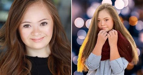 Girl With Down Syndrome Became A Model After Doctors Told Her Mum To Put Her Up For Adoption