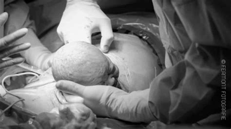 Aprender Sobre 49 Imagem Fotos Nascimento Bebe Vn
