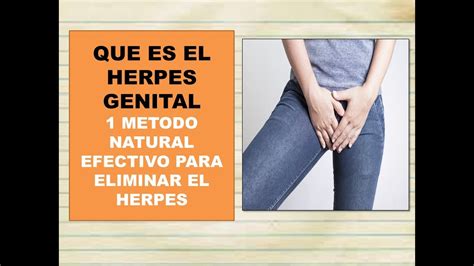 Como Curar El Herpes Genital Como Tratar El Herpes Genital En