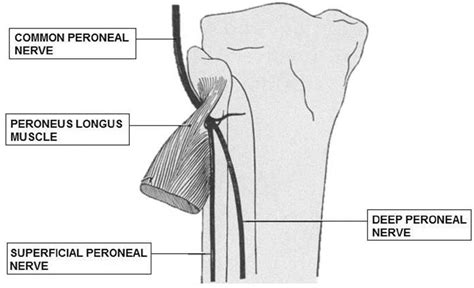 Common Site Of Compression In Fibular Peroneal Nerve Entrapment The