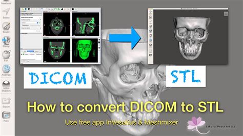 how to convert dicom file to 3d printable stl file youtube
