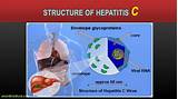 Photos of Ayurvedic Treatment For Chronic Hepatitis B