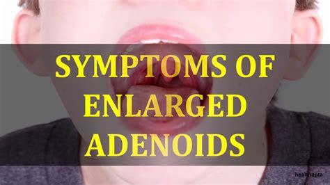 Symptoms Of Enlarged Adenoids Youtube