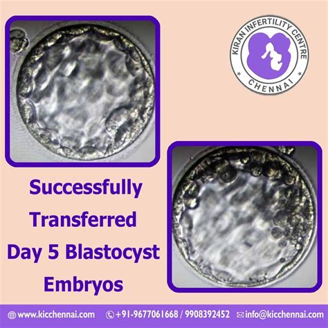 Successful Transfer Day Blastocyst Embryos