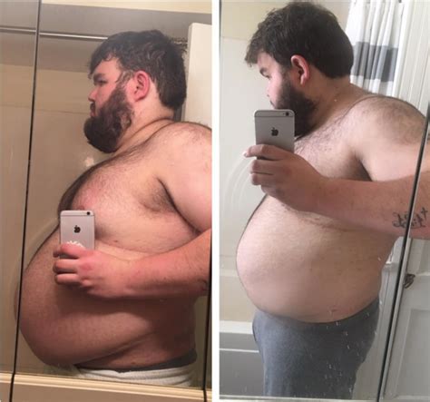 Man Achieves 160 Lb Weight Loss Transformation Improves Mental Health