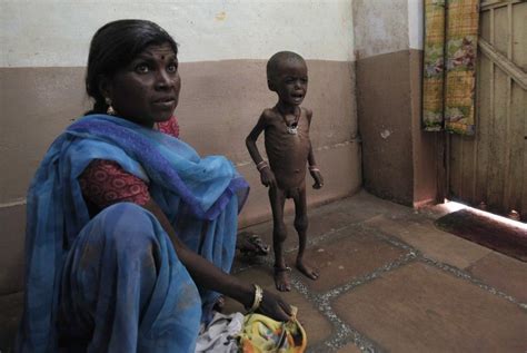 Malnutrition ‘a National Shame In India Photos Ibtimes