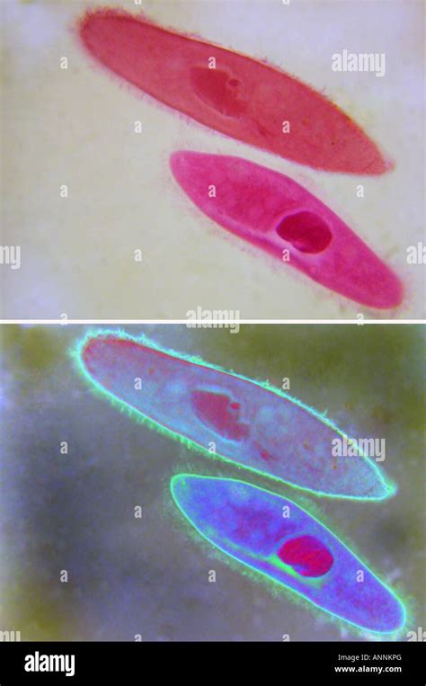 Paramecium Under Microscope 40x