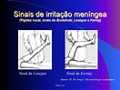 160258744 semiologia neurol c3 b3gica sem v c3 addeos by Apahe Portugal ...
