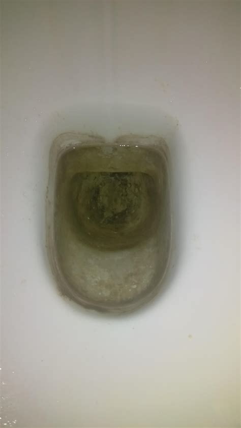 What Is This At The Bottom Of The Toilet And How Do I Clean It R Cleaningtips