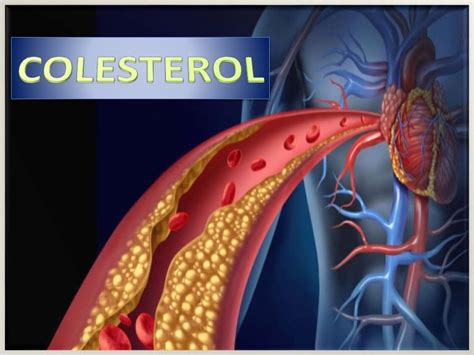 Diapositivas De Colesterol 2016