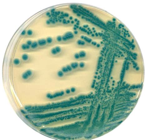 Bacillus Cereus Selective Media For Unpasteurized Food Samples