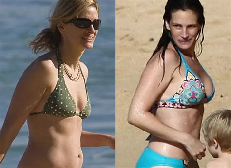Julia Roberts Breast Implants Plastic Surgery Before And After Celebie