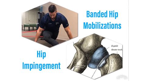 Hip Impingement Banded Hip Mobilizations Youtube