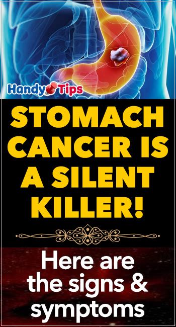 43 Sign And Symptoms Cancer In The Stomach Png Cancer Diagnosis