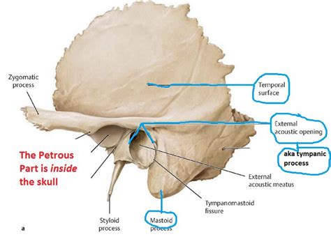 Temporal Bone Anatomy Bones Anatomy Human Anatomy And Physiology