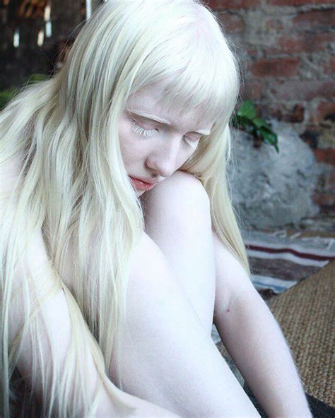 Albino People Wholl Mesmerize You With Their Otherworldly Beauty Artofit