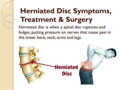 Herniated discs in the neck area are often related to nerve compression and include a wider range of symptoms. PPT - Herniated Disc Symptoms, Treatment & Surgery PowerPoint Presentation - ID:7387854