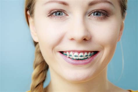 Orthodontics For Teens Braces Canton Invisalign Canton
