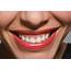 5 Reasons Pretty Teeth Are Also Good For Your Health  Glamour