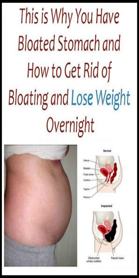 Having Troubles With A Bloated Stomach Here Are The Habits You Need To Get Rid Of Bloated